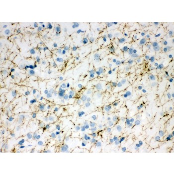 TH / Tyrosine Hydroxylase Antibody - TH antibody IHC-paraffin. IHC(P): Rat Brain Tissue.