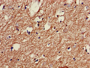 TH / Tyrosine Hydroxylase Antibody - Immunohistochemistry of paraffin-embedded human brain tissue at dilution of 1:100