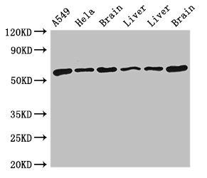 TH / Tyrosine Hydroxylase Antibody - Western Blot Positive WB detected in:A549 whole cell lysate,Hela whole cell lysate,Rat brain tissue,Rat liver tissue,Mouse liver tissue,Mouse brain tissue All Lanes:TH antibody at 4µg/ml Secondary Goat polyclonal to rabbit IgG at 1/50000 dilution Predicted band size: 59,56,57,46,45 KDa Observed band size: 59 KDa