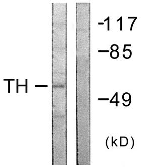 TH / Tyrosine Hydroxylase Antibody - Western blot analysis of lysates from COLO205 cells, using Tyrosine Hydroxylase Antibody. The lane on the right is blocked with the synthesized peptide.