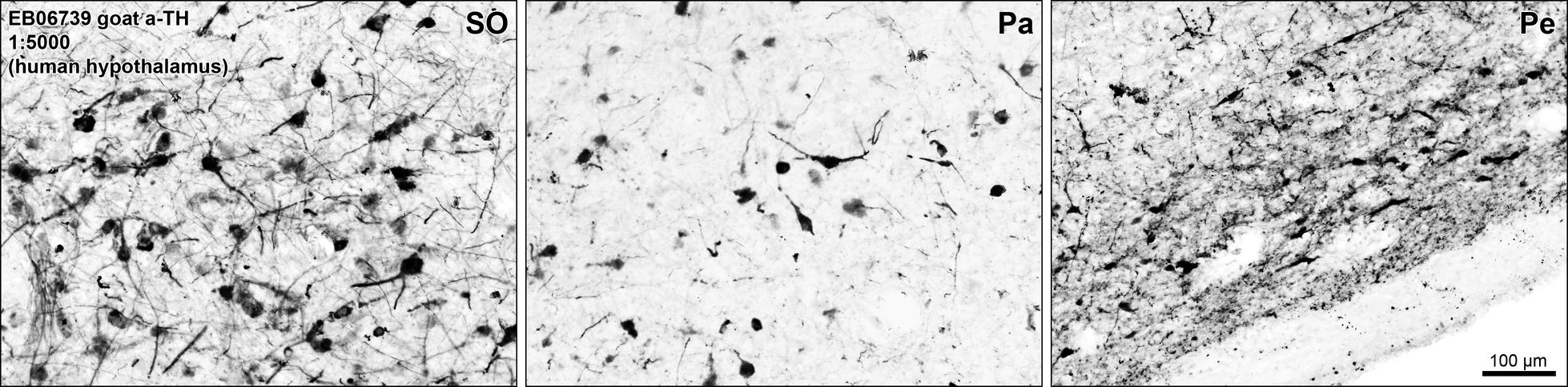 TH / Tyrosine Hydroxylase Antibody - EB6739 (0.1µg/ml) staining of PFA-perfused cryosection of Human Hypothalamic supraoptic (SO), paraventricular (Pa) and periventricular (Pe) nuclei. Antigen retrieval with citrate buffer pH 6 at 80C for 30min, HRP-staining with Ni-DAB after Biotin-SP-antigoat amplification.