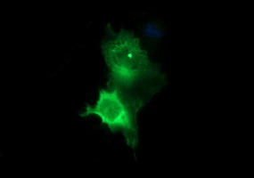 TH / Tyrosine Hydroxylase Antibody - Anti-TH mouse monoclonal antibody immunofluorescent staining of COS7 cells transiently transfected by pCMV6-ENTRY TH.