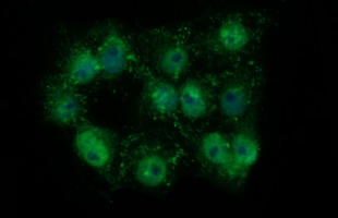 TH / Tyrosine Hydroxylase Antibody - Anti-TH mouse monoclonal antibody immunofluorescent staining of COS7 cells transiently transfected by pCMV6-ENTRY TH.