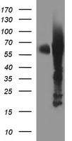 TH / Tyrosine Hydroxylase Antibody - HEK293T cells were transfected with the pCMV6-ENTRY control (Left lane) or pCMV6-ENTRY TH (Right lane) cDNA for 48 hrs and lysed. Equivalent amounts of cell lysates (5 ug per lane) were separated by SDS-PAGE and immunoblotted with anti-TH.