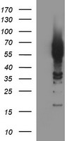 TH / Tyrosine Hydroxylase Antibody - HEK293T cells were transfected with the pCMV6-ENTRY control (Left lane) or pCMV6-ENTRY TH (Right lane) cDNA for 48 hrs and lysed. Equivalent amounts of cell lysates (5 ug per lane) were separated by SDS-PAGE and immunoblotted with anti-TH.