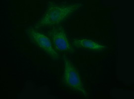 TH / Tyrosine Hydroxylase Antibody - Immunofluorescent staining of HeLa cells using anti-TH mouse monoclonal antibody.