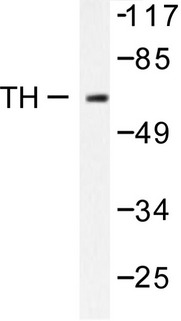 TH / Tyrosine Hydroxylase Antibody - Western blot of Tyrosine Hydroxylase (Q25) pAb in extracts from 293 cells treated with UV 15' or COS7 cells treated with Heat shock.