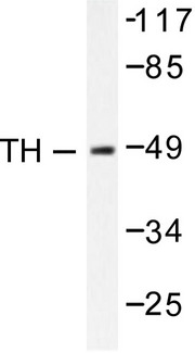TH / Tyrosine Hydroxylase Antibody - Western blot of Tyrosine Hydroxylase (G13) pAb in extracts from NIH/3T3 cells treated with Forskolin 40nM 30'.