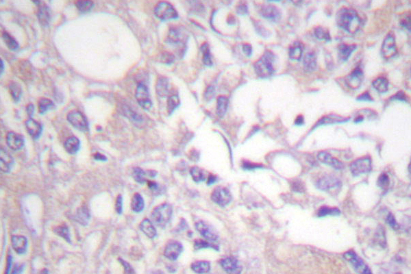 TH / Tyrosine Hydroxylase Antibody - IHC of Tyrosine Hydroxylase (G13) pAb in paraffin-embedded human brain tissue.
