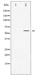 TH / Tyrosine Hydroxylase Antibody - Western blot of Tyrosine Hydroxylase expression in UV treated 293 whole cell lysates,The lane on the left is treated with the antigen-specific peptide.