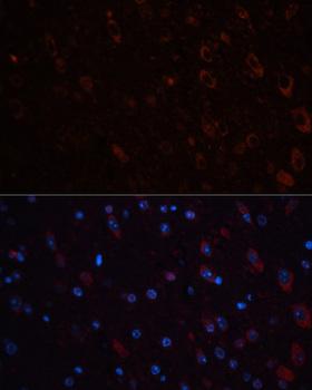 TH / Tyrosine Hydroxylase Antibody - Immunofluorescence analysis of mouse brain using TH antibody at dilution of 1:100 (40x lens). Blue: DAPI for nuclear staining.