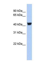 TH / Tyrosine Hydroxylase Antibody - TH / Tyrosine Hydroxylase antibody Western blot of Fetal Stomach lysate. This image was taken for the unconjugated form of this product. Other forms have not been tested.