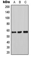 TH / Tyrosine Hydroxylase Antibody - Western blot analysis of Tyrosine Hydroxylase expression in DLD (A); mouse liver (B); PC12 (C) whole cell lysates.