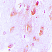 TH / Tyrosine Hydroxylase Antibody - Immunohistochemical analysis of Tyrosine Hydroxylase staining in human brain formalin fixed paraffin embedded tissue section. The section was pre-treated using heat mediated antigen retrieval with sodium citrate buffer (pH 6.0). The section was then incubated with the antibody at room temperature and detected using an HRP conjugated compact polymer system. DAB was used as the chromogen. The section was then counterstained with hematoxylin and mounted with DPX.