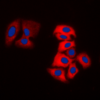 TH / Tyrosine Hydroxylase Antibody - Immunofluorescent analysis of Tyrosine Hydroxylase staining in DLD cells. Formalin-fixed cells were permeabilized with 0.1% Triton X-100 in TBS for 5-10 minutes and blocked with 3% BSA-PBS for 30 minutes at room temperature. Cells were probed with the primary antibody in 3% BSA-PBS and incubated overnight at 4 C in a humidified chamber. Cells were washed with PBST and incubated with a DyLight 594-conjugated secondary antibody (red) in PBS at room temperature in the dark. DAPI was used to stain the cell nuclei (blue).