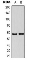 TH / Tyrosine Hydroxylase Antibody - Western blot analysis of Tyrosine Hydroxylase expression in A549 (A); NIH3T3 (B) whole cell lysates.