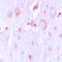 TH / Tyrosine Hydroxylase Antibody - Immunohistochemical analysis of Tyrosine Hydroxylase staining in human brain formalin fixed paraffin embedded tissue section. The section was pre-treated using heat mediated antigen retrieval with sodium citrate buffer (pH 6.0). The section was then incubated with the antibody at room temperature and detected using an HRP conjugated compact polymer system. DAB was used as the chromogen. The section was then counterstained with hematoxylin and mounted with DPX.