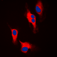 TH / Tyrosine Hydroxylase Antibody - Immunofluorescent analysis of Tyrosine Hydroxylase staining in A549 cells. Formalin-fixed cells were permeabilized with 0.1% Triton X-100 in TBS for 5-10 minutes and blocked with 3% BSA-PBS for 30 minutes at room temperature. Cells were probed with the primary antibody in 3% BSA-PBS and incubated overnight at 4 C in a humidified chamber. Cells were washed with PBST and incubated with a DyLight 594-conjugated secondary antibody (red) in PBS at room temperature in the dark. DAPI was used to stain the cell nuclei (blue).