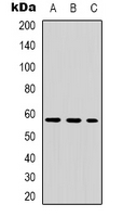 TH / Tyrosine Hydroxylase Antibody - Western blot analysis of Tyrosine Hydroxylase (pS8) expression in HEK293T (A); HepG2 (B); NIH3T3 (C) whole cell lysates.