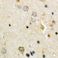 TH / Tyrosine Hydroxylase Antibody - Immunohistochemical analysis of Tyrosine Hydroxylase (pS8) staining in human brain formalin fixed paraffin embedded tissue section. The section was pre-treated using heat mediated antigen retrieval with sodium citrate buffer (pH 6.0). The section was then incubated with the antibody at room temperature and detected with HRP and DAB as chromogen. The section was then counterstained with hematoxylin and mounted with DPX.