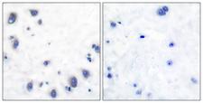 TH / Tyrosine Hydroxylase Antibody - Peptide - + Immunohistochemical analysis of paraffin-embedded human brain tissue using Tyrosine Hydroxylase (Ab-40) antibody.