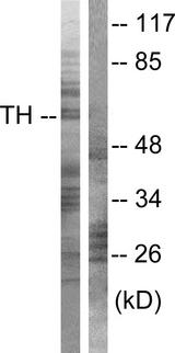TH / Tyrosine Hydroxylase Antibody - Western blot analysis of extracts from 3T3 cells treated with Forskolin (40nM, 30min), using Tyrosine Hydroxylase (Ab-40) antibody ( Line 1 and 2).
