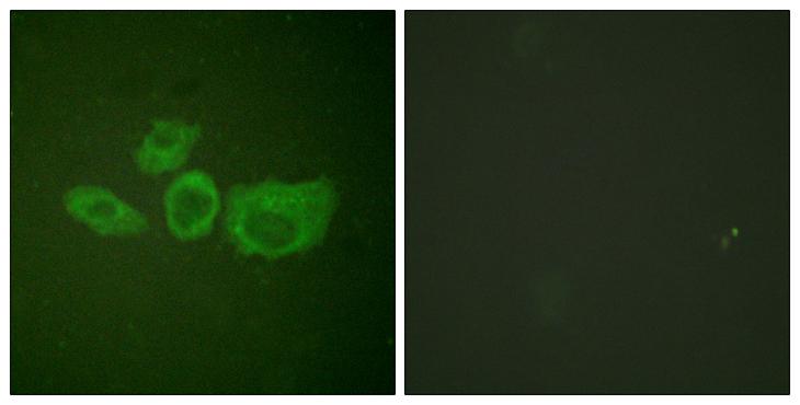 TH / Tyrosine Hydroxylase Antibody - Peptide - + Immunofluorescence analysis of HuvEc cells, using Tyrosine Hydroxylase (Ab-40) antibody.