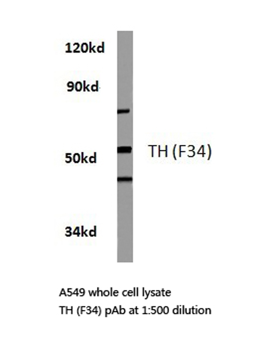 TH / Tyrosine Hydroxylase Antibody - Western blot of Tyrosine Hydroxylase (F34) pAb in extracts from A549 cells.