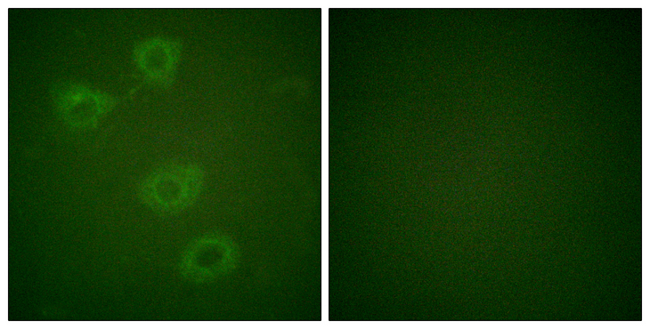 TH / Tyrosine Hydroxylase Antibody - Immunofluorescence analysis of HUVEC cells, using Tyrosine Hydroxylase (Phospho-Ser19) Antibody. The picture on the right is blocked with the phospho peptide.