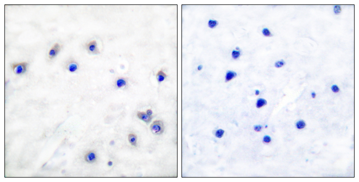 TH / Tyrosine Hydroxylase Antibody - Immunohistochemistry analysis of paraffin-embedded human brain, using Tyrosine Hydroxylase (Phospho-Ser19) Antibody. The picture on the right is blocked with the phospho peptide.