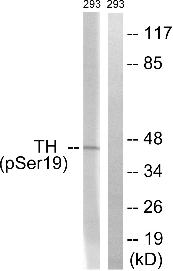 TH / Tyrosine Hydroxylase Antibody - Western blot analysis of lysates from 293 cells treated with Insulin 0.01U/ml 30', using Tyrosine Hydroxylase (Phospho-Ser19) Antibody. The lane on the right is blocked with the phospho peptide.
