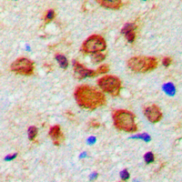 TH / Tyrosine Hydroxylase Antibody - Immunohistochemical analysis of Tyrosine Hydroxylase (pS19) staining in human brain formalin fixed paraffin embedded tissue section. The section was pre-treated using heat mediated antigen retrieval with sodium citrate buffer (pH 6.0). The section was then incubated with the antibody at room temperature and detected using an HRP conjugated compact polymer system. DAB was used as the chromogen. The section was then counterstained with hematoxylin and mounted with DPX.