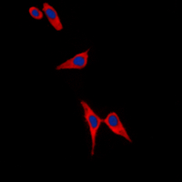 TH / Tyrosine Hydroxylase Antibody - Immunofluorescent analysis of Tyrosine Hydroxylase (pS19) staining in A549 cells. Formalin-fixed cells were permeabilized with 0.1% Triton X-100 in TBS for 5-10 minutes and blocked with 3% BSA-PBS for 30 minutes at room temperature. Cells were probed with the primary antibody in 3% BSA-PBS and incubated overnight at 4 deg C in a humidified chamber. Cells were washed with PBST and incubated with a DyLight 594-conjugated secondary antibody (red) in PBS at room temperature in the dark. DAPI was used to stain the cell nuclei (blue).