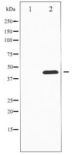 TH / Tyrosine Hydroxylase Antibody - Western blot of Tyrosine Hydroxylase phosphorylation expression in PC12 whole cell lysates,The lane on the left is treated with the antigen-specific peptide.