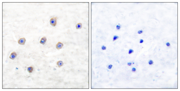 TH / Tyrosine Hydroxylase Antibody - Immunohistochemistry analysis of paraffin-embedded human brain, using Tyrosine Hydroxylase (Phospho-Ser31) Antibody. The picture on the right is blocked with the phospho peptide.