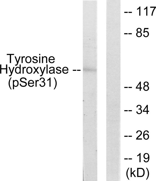 TH / Tyrosine Hydroxylase Antibody - Western blot analysis of lysates from 293 cells treated with UV 15', using Tyrosine Hydroxylase (Phospho-Ser31) Antibody. The lane on the right is blocked with the phospho peptide.