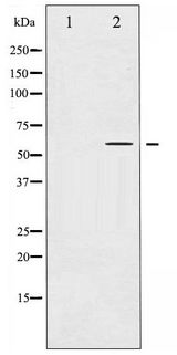 TH / Tyrosine Hydroxylase Antibody - Western blot of Tyrosine Hydroxylase phosphorylation expression in UV treated 293 whole cell lysates,The lane on the left is treated with the antigen-specific peptide.
