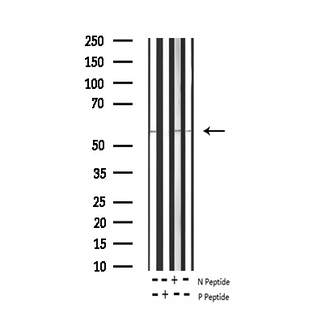 TH / Tyrosine Hydroxylase Antibody - Western blot analysis of Phospho-Tyrosine Hydroxylase (Ser31) expression in various lysates