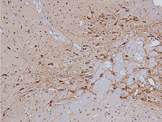 TH / Tyrosine Hydroxylase Antibody - 1:200 staining rat brain tissue by IHC-P. The tissue was formaldehyde fixed and a heat mediated antigen retrieval step in citrate buffer was performed. The tissue was then blocked and incubated with the antibody for 1.5 hours at 22°C. An HRP conjugated goat anti-rabbit antibody was used as the secondary.