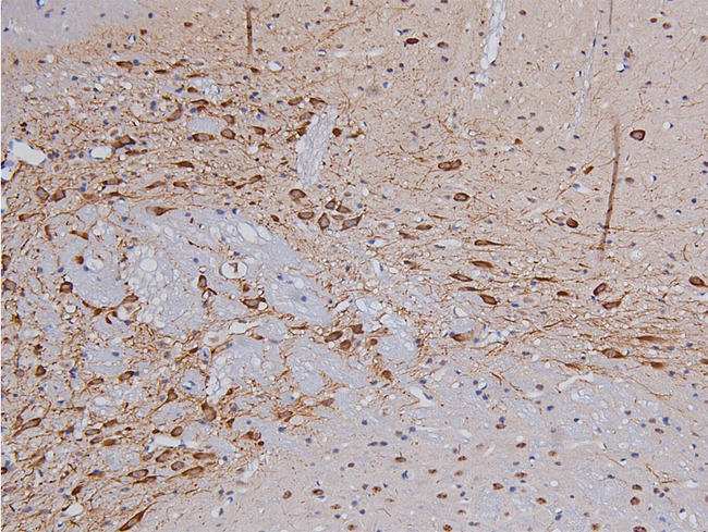 TH / Tyrosine Hydroxylase Antibody - 1:200 staining rat brain tissue by IHC-P. The tissue was formaldehyde fixed and a heat mediated antigen retrieval step in citrate buffer was performed. The tissue was then blocked and incubated with the antibody for 1.5 hours at 22°C. An HRP conjugated goat anti-rabbit antibody was used as the secondary.