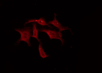 TH / Tyrosine Hydroxylase Antibody - Staining 293 cells by IF/ICC. The samples were fixed with PFA and permeabilized in 0.1% Triton X-100, then blocked in 10% serum for 45 min at 25°C. The primary antibody was diluted at 1:200 and incubated with the sample for 1 hour at 37°C. An Alexa Fluor 594 conjugated goat anti-rabbit IgG (H+L) Ab, diluted at 1/600, was used as the secondary antibody.