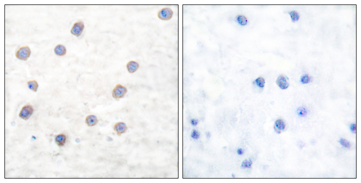 TH / Tyrosine Hydroxylase Antibody - Immunohistochemistry analysis of paraffin-embedded human brain, using Tyrosine Hydroxylase (Phospho-Ser40) Antibody. The picture on the right is blocked with the phospho peptide.