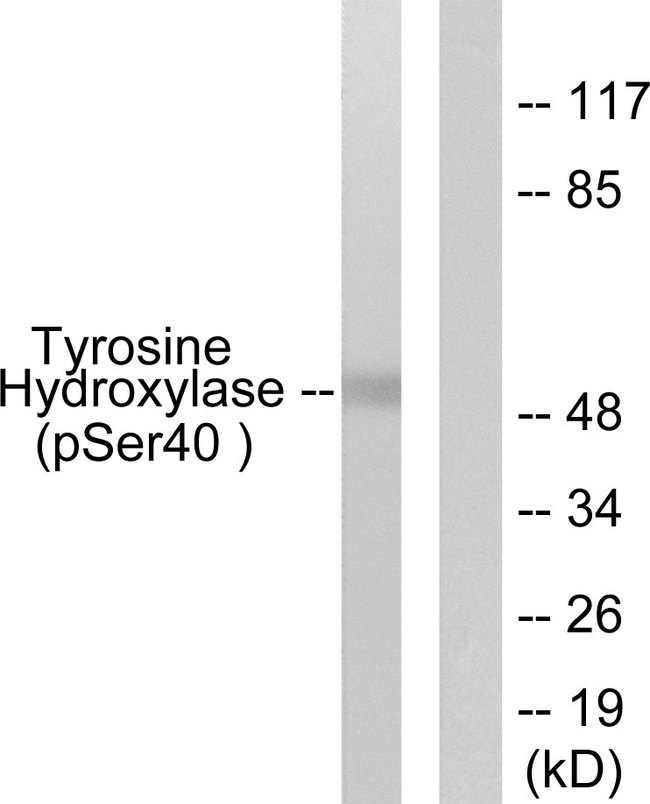 TH / Tyrosine Hydroxylase Antibody - Western blot analysis of lysates from RAW264.7 cells treated with UV 30', using Tyrosine Hydroxylase (Phospho-Ser40) Antibody. The lane on the right is blocked with the phospho peptide.