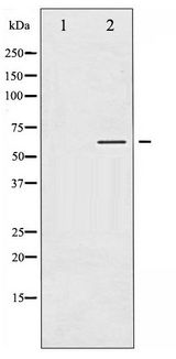 TH / Tyrosine Hydroxylase Antibody - Western blot of Tyrosine Hydroxylase phosphorylation expression in RAW264.7 whole cell lysates,The lane on the left is treated with the antigen-specific peptide.