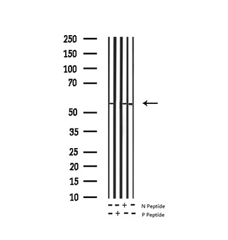 TH / Tyrosine Hydroxylase Antibody - Western blot analysis of Phospho-Tyrosine Hydroxylase (Ser40) expression in various lysates