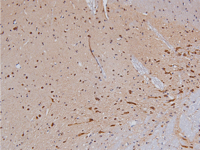 TH / Tyrosine Hydroxylase Antibody - 1:200 staining rat brain tissue by IHC-P. The tissue was formaldehyde fixed and a heat mediated antigen retrieval step in citrate buffer was performed. The tissue was then blocked and incubated with the antibody for 1.5 hours at 22°C. An HRP conjugated goat anti-rabbit antibody was used as the secondary.