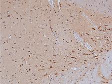 TH / Tyrosine Hydroxylase Antibody - 1:200 staining rat brain tissue by IHC-P. The tissue was formaldehyde fixed and a heat mediated antigen retrieval step in citrate buffer was performed. The tissue was then blocked and incubated with the antibody for 1.5 hours at 22°C. An HRP conjugated goat anti-rabbit antibody was used as the secondary.
