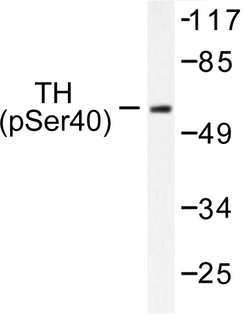 TH / Tyrosine Hydroxylase Antibody - Western blot of p-TH (S71) pAb in extracts from HepG2 cells treated with Forskolin.