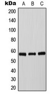 TH / Tyrosine Hydroxylase Antibody - Western blot analysis of Tyrosine Hydroxylase (pS71) expression in HepG2 UV-treated (A); mouse brain (B); PC12 (C) whole cell lysates.