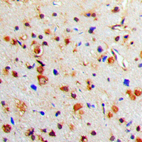 TH / Tyrosine Hydroxylase Antibody - Immunohistochemical analysis of Tyrosine Hydroxylase (pS71) staining in human brain formalin fixed paraffin embedded tissue section. The section was pre-treated using heat mediated antigen retrieval with sodium citrate buffer (pH 6.0). The section was then incubated with the antibody at room temperature and detected using an HRP conjugated compact polymer system. DAB was used as the chromogen. The section was then counterstained with hematoxylin and mounted with DPX.